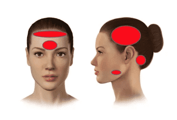 Botox cosmetic dentist in fayetteville nc