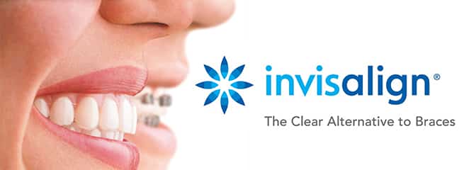 invisalign clear braces