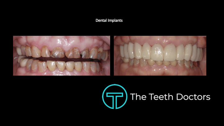 Dentist Fayetteville NC Before and After