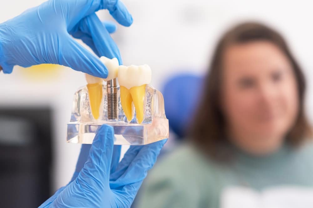Cost of Dental Implants