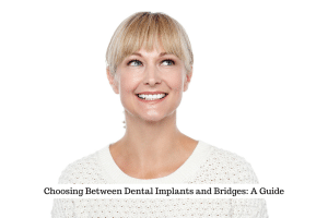 Choosing Between Dental Implants and Bridges