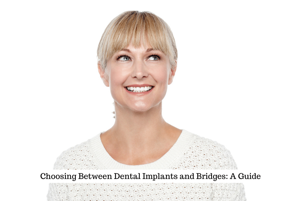 Choosing Between Dental Implants and Bridges