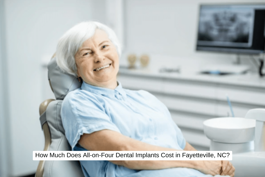 How Much Does All-on-Four Dental Implants Cost in Fayetteville, NC